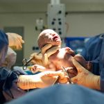 Sífilis congénita: enfermedad prevenible y tratable que sigue en aumento