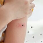 Dengue: síntomas (signos de alarma),  diagnóstico y prevención